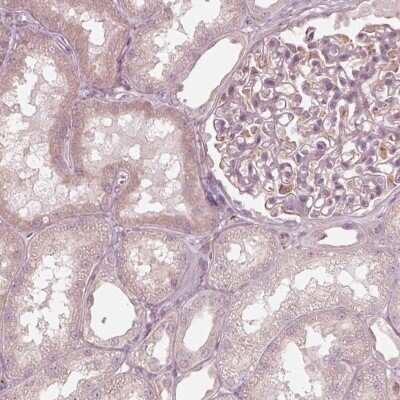 Immunohistochemistry-Paraffin: Rab3C Antibody [NBP2-55288]