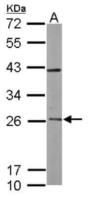 Western Blot: Rab3C Antibody [NBP1-32871]