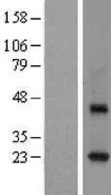 Western Blot: Rab3C Overexpression Lysate [NBL1-15072]