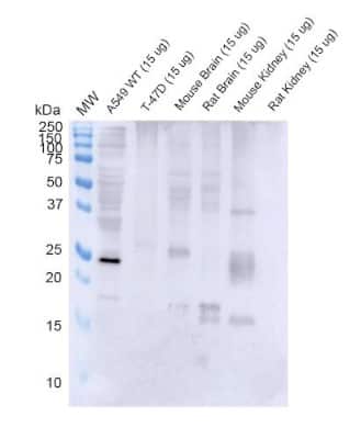 Western Blot: Rab3D Antibody (5E9) [NBP3-14764]
