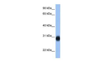 Western Blot: Rab3D Antibody [NBP2-85577]