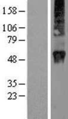 Western Blot: Rab3D Overexpression Lysate [NBP2-07888]