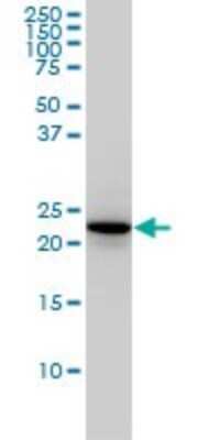 Western Blot: Rab4 Antibody (1C10) [H00005867-M01]