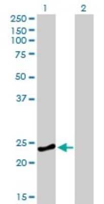 Western Blot: Rab4 Antibody (1C10) [H00005867-M01]