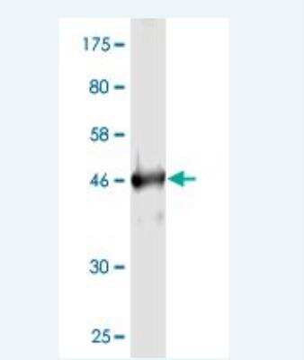 Western Blot: Rab4 Antibody (1E1) [H00005867-M02]