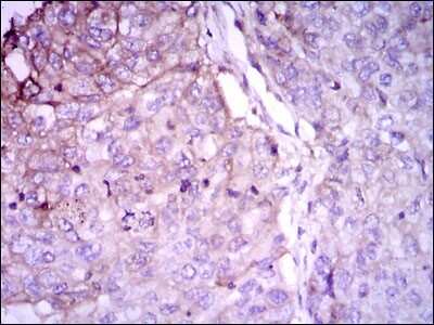 Immunohistochemistry-Paraffin: Rab4 Antibody (4E11) - BSA Free [NBP2-37485]