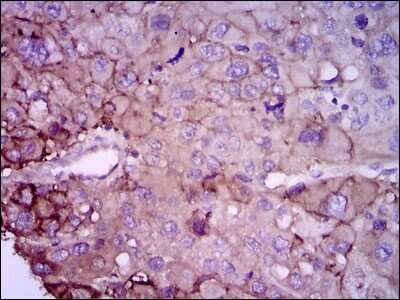 Immunohistochemistry-Paraffin: Rab4 Antibody (4E11) - BSA Free [NBP2-37485]