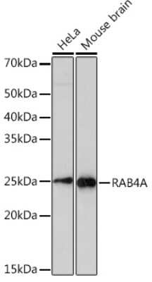 Western Blot: Rab4 Antibody (8I5K1) [NBP3-16307]