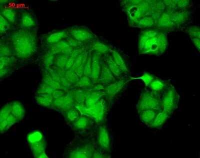 Immunocytochemistry/ Immunofluorescence: Rab4 Antibody [NBP3-18233]