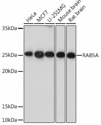 Western Blot: Rab5a Antibody (0K5J1) [NBP3-15442]