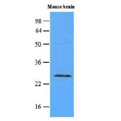 Western Blot: Rab5a Antibody (3A4)BSA Free [NBP1-04340]