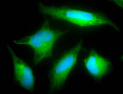 Immunocytochemistry/ Immunofluorescence: Rab5a Antibody [NB120-13253]