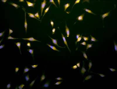 Immunocytochemistry/ Immunofluorescence: Rab5a Antibody [NB120-13253]