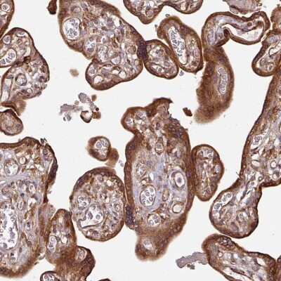Immunohistochemistry-Paraffin: Rab5a Antibody [NBP2-58129]