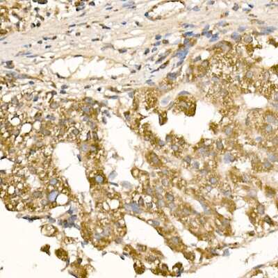 Immunohistochemistry-Paraffin: Rab5a Antibody - Azide and BSA Free [NBP3-03360]
