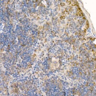 Immunohistochemistry-Paraffin: Rab5a Antibody - Azide and BSA Free [NBP3-03360]