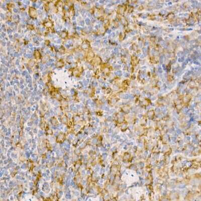Immunohistochemistry-Paraffin: Rab5a Antibody - Azide and BSA Free [NBP3-03360]