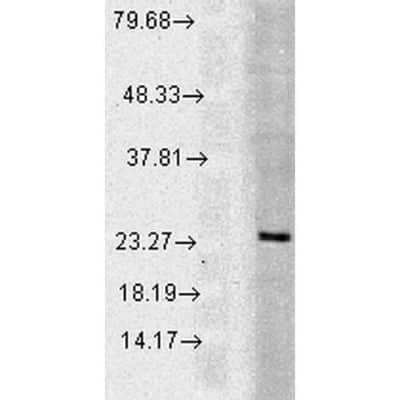 Western Blot: Rab5a Antibody [NB120-13253]