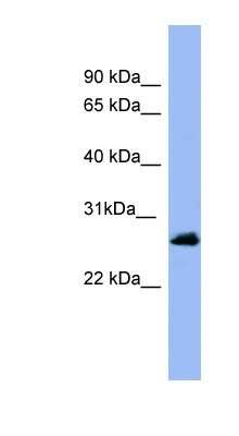 Western Blot: Rab5a Antibody [NBP1-58880]