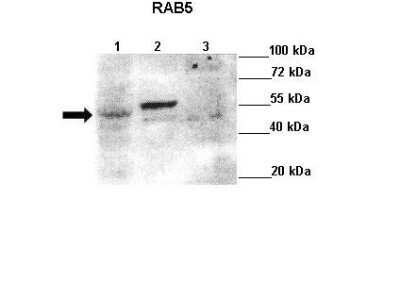 Western Blot: Rab5a Antibody [NBP1-58927]