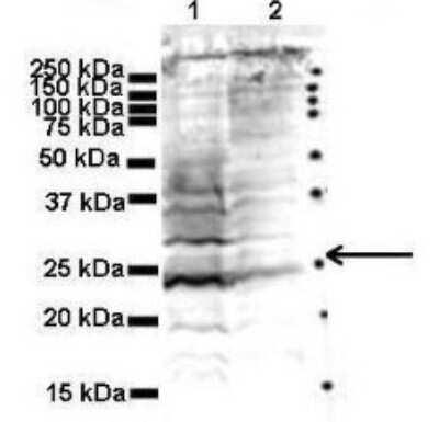 Western Blot: Rab5a Antibody [NBP1-98322]