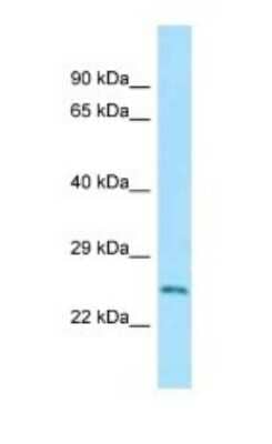 Western Blot: Rab5a Antibody [NBP1-98322]