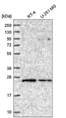 Western Blot: Rab5a Antibody [NBP2-58129]