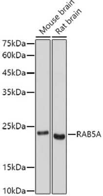 Western Blot: Rab5a AntibodyAzide and BSA Free [NBP3-03360]