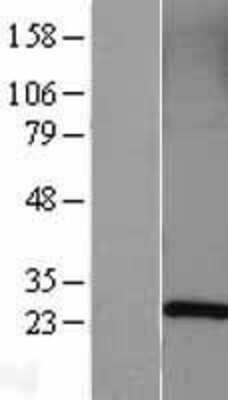 Western Blot: Rab5a Overexpression Lysate [NBL1-15082]