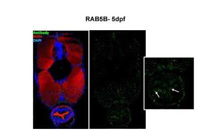 Immunohistochemistry-Paraffin: Rab5b Antibody [NBP1-58938]