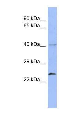 Western Blot: Rab5b Antibody [NBP1-58938]