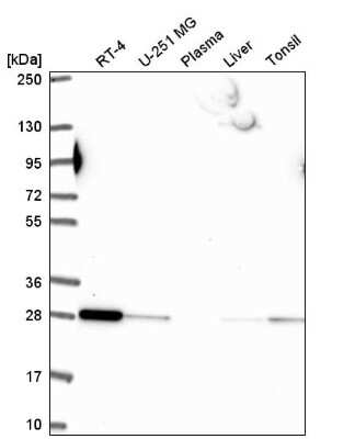 Western Blot: Rab5b Antibody [NBP2-57752]