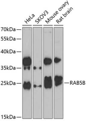 Western Blot: Rab5b AntibodyAzide and BSA Free [NBP2-94902]