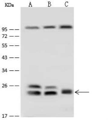 Western Blot: Rab5b Antibody [NBP2-99625]