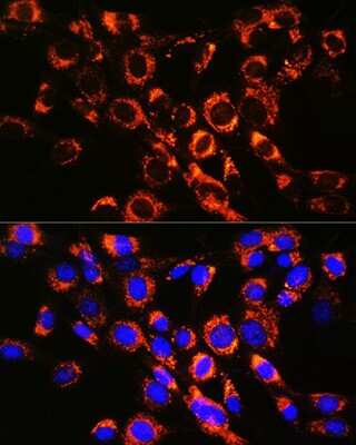 Immunocytochemistry/ Immunofluorescence: Rab7a Antibody (5A10A4) [NBP3-15444]
