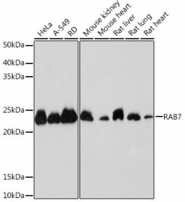 Western Blot: Rab7a Antibody (5A10A4) [NBP3-15444]