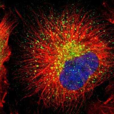 Immunocytochemistry/ Immunofluorescence: Rab7a Antibody [NBP1-87174]