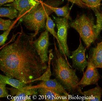 Immunocytochemistry/ Immunofluorescence: Rab7a Antibody - BSA Free [NBP2-24591]