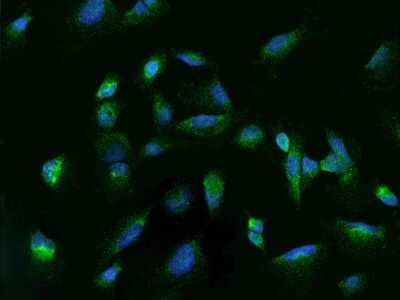 Immunocytochemistry/ Immunofluorescence: Rab7a Antibody [NBP2-97183]