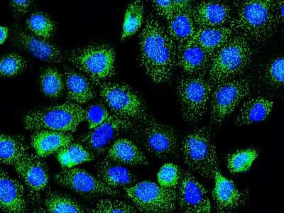 Immunocytochemistry/ Immunofluorescence: Rab7a Antibody [NBP2-98732]