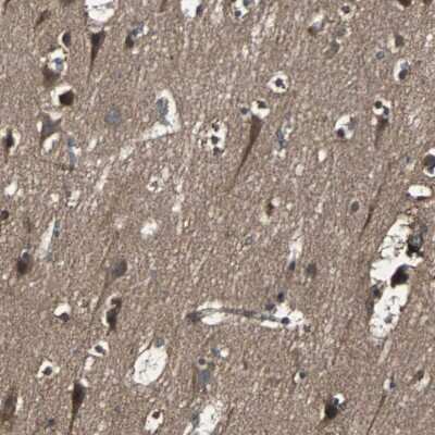 Immunohistochemistry-Paraffin: Rab7a Antibody [NBP1-87174]