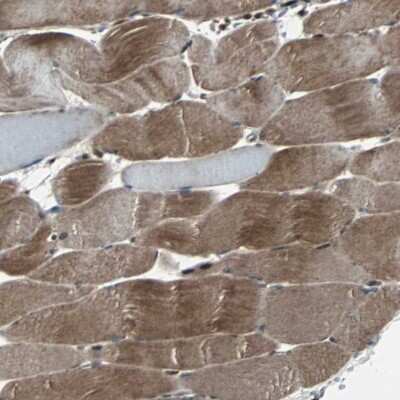 Immunohistochemistry-Paraffin: Rab7a Antibody [NBP1-87174]