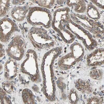 Immunohistochemistry-Paraffin: Rab7a Antibody [NBP1-87174]