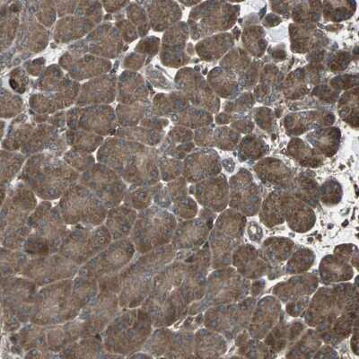 Immunohistochemistry-Paraffin: Rab7a Antibody [NBP1-87174]