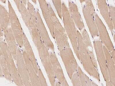 Immunohistochemistry-Paraffin: Rab7a Antibody [NBP2-97183]