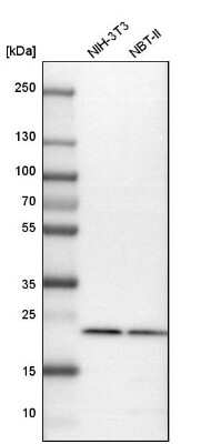 Western Blot: Rab7a Antibody [NBP1-87174]
