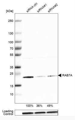 Western Blot: Rab7a Antibody [NBP1-87174]