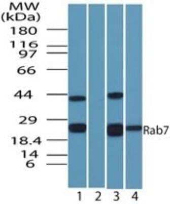 Western Blot: Rab7a AntibodyBSA Free [NBP2-24591]