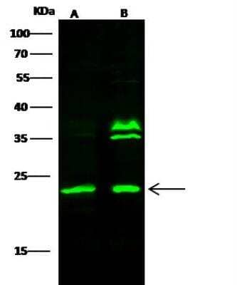 Western Blot: Rab7a Antibody [NBP2-98446]