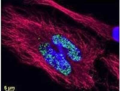 Immunocytochemistry/ Immunofluorescence: Rabbit anti-Mouse IgG1 Heavy Chain Secondary Antibody [NBP1-72793]